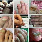 Poderoso tratamiento para combatir los hongos de las uñas NONYX NAIL GEL ⭐⭐⭐⭐⭐